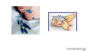 2021 Sociedad Europea de Medicina de Cuidados
Intensivos y sociedad de Medicina de Cuidados
intensivos
 