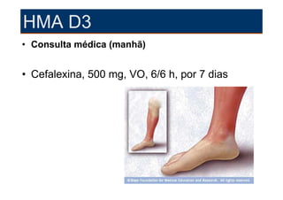 HMA D3
• Consulta médica (manhã)


• Cefalexina, 500 mg, VO, 6/6 h, por 7 dias
 