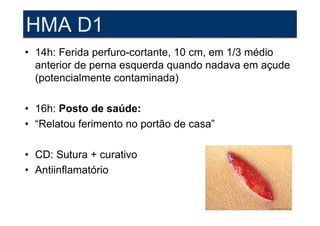 HMA D1
• 14h: Ferida perfuro-cortante, 10 cm, em 1/3 médio
  anterior de perna esquerda quando nadava em açude
  (potencialmente contaminada)

• 16h: Posto de saúde:
• “Relatou ferimento no portão de casa”

• CD: Sutura + curativo
• Antiinflamatório
 