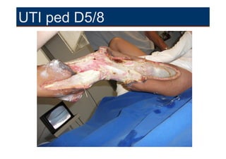 UTI ped D5/8
 