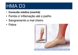 HMA D3
• Consulta médica (manhã)
• Ferida c/ inflamação até o joelho
• Sangramento e mal cheiro
• Febre
 