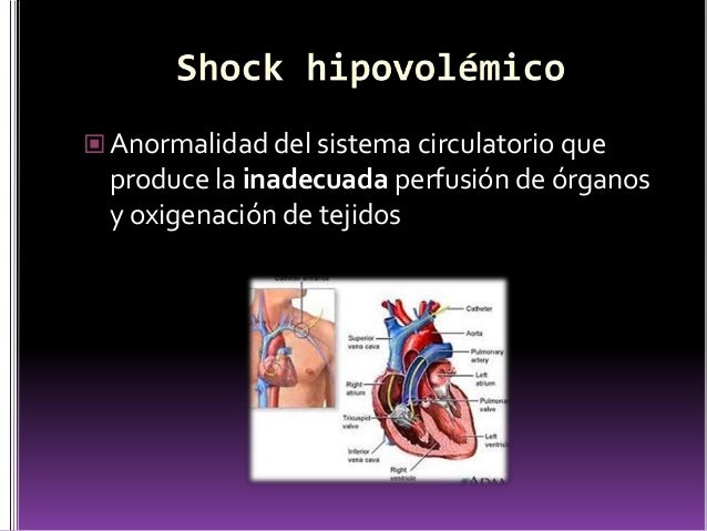 Choque Séptico