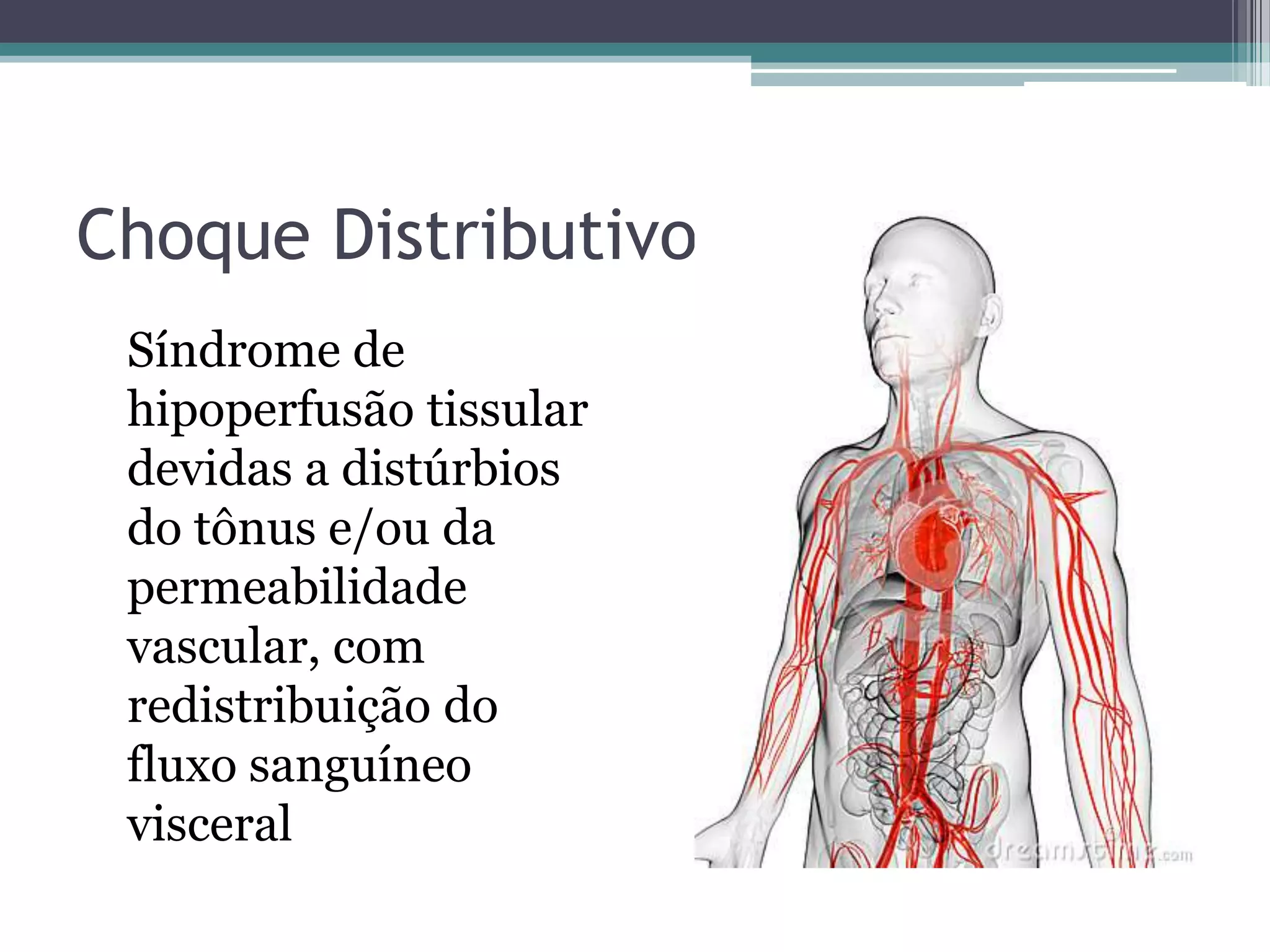 Choque Distributivo
Síndrome de
hipoperfusão tissular
devidas a distúrbios
do tônus e/ou da
permeabilidade
vascular, com
redistribuição do
fluxo sanguíneo
visceral
 