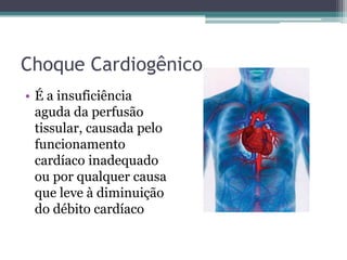 Choque Cardiogênico
• É a insuficiência
aguda da perfusão
tissular, causada pelo
funcionamento
cardíaco inadequado
ou por qualquer causa
que leve à diminuição
do débito cardíaco
 