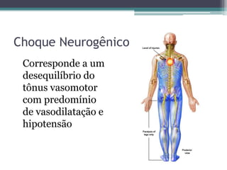 Choque Neurogênico
Corresponde a um
desequilíbrio do
tônus vasomotor
com predomínio
de vasodilatação e
hipotensão
 