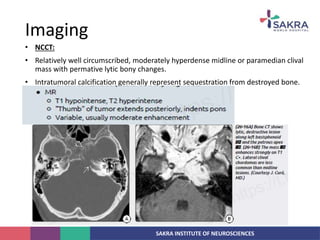 SAKRA INSTITUTE OF NEUROSCIENCES
• NCCT:
• Relatively well circumscribed, moderately hyperdense midline or paramedian clival
mass with permative lytic bony changes.
• Intratumoral calcification generally represent sequestration from destroyed bone.
Imaging
 