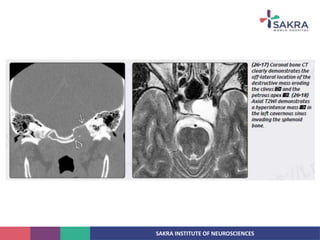 SAKRA INSTITUTE OF NEUROSCIENCES
 