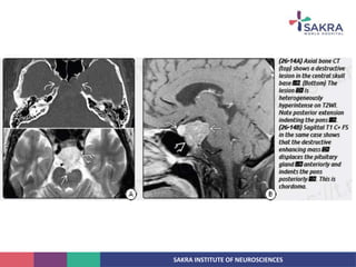 SAKRA INSTITUTE OF NEUROSCIENCES
 