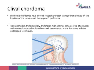 SAKRA INSTITUTE OF NEUROSCIENCES
• Skull-base chordomas have a broad surgical approach strategy that is based on the
location of the tumour and the surgeon’s preference.
• Transphenoidal, trans maxillary, transnasal, high anterior cervical retro pharyngeal,
and transoral approaches have been well documented in the literature, as have
endoscopic techniques.
Clival chordoma
 