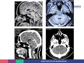 SAKRA INSTITUTE OF NEUROSCIENCES
 