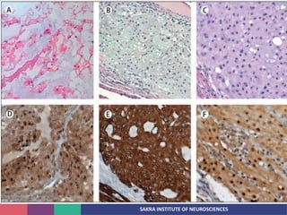 SAKRA INSTITUTE OF NEUROSCIENCES
 