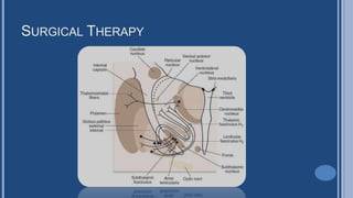 SURGICAL THERAPY
 