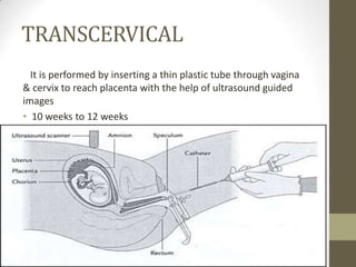 TRANSCERVICAL
It is performed by inserting a thin plastic tube through vagina
& cervix to reach placenta with the help of ultrasound guided
images
• 10 weeks to 12 weeks

 