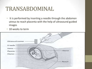 TRANSABDOMINAL
• It is performed by inserting a needle through the abdomen
utreus to reach placenta with the help of ultrasound guided
images
• 10 weeks to term

 