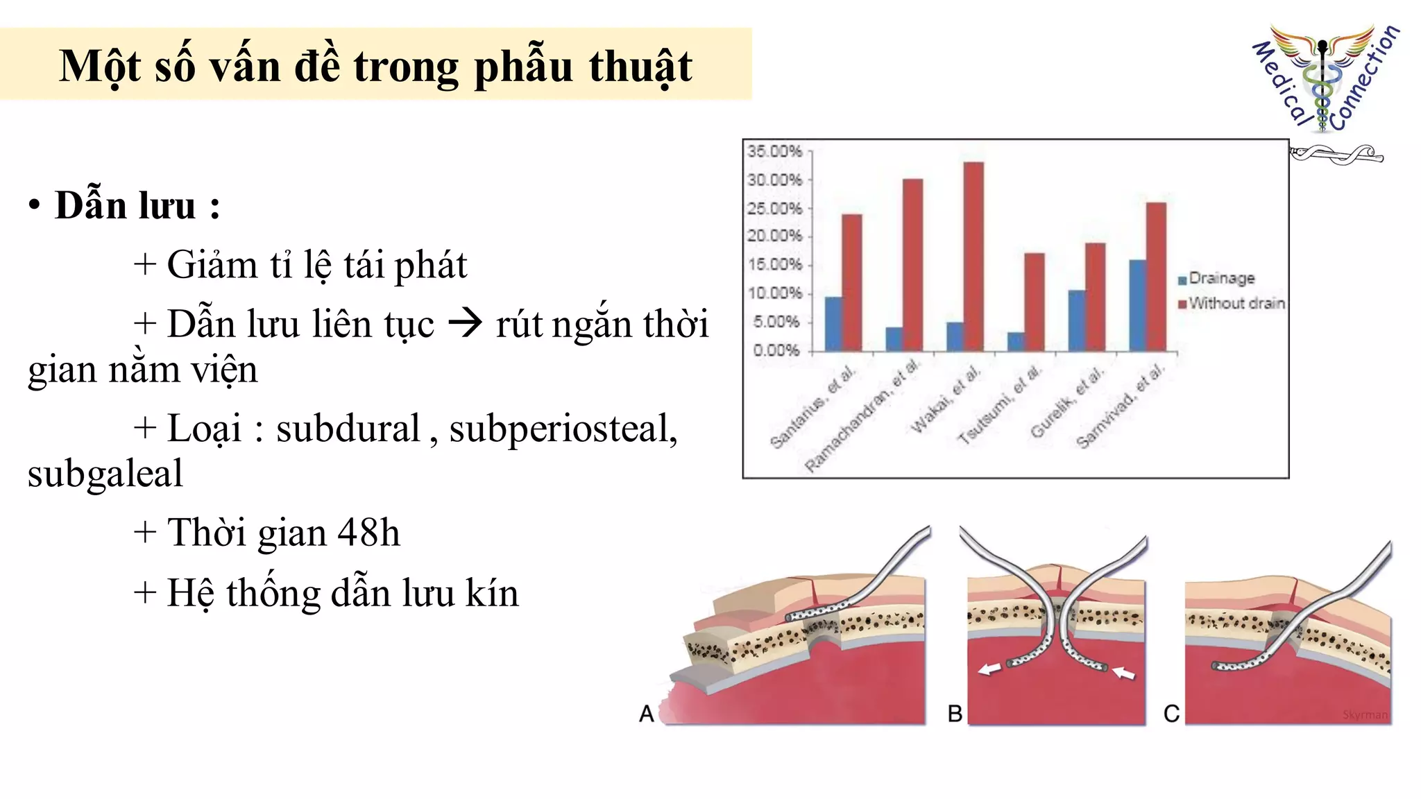 • Dẫn lưu :
+ Giảm tỉ lệ tái phát
+ Dẫn lưu liên tục  rút ngắn thời
gian nằm viện
+ Loại : subdural , subperiosteal,
subgaleal
+ Thời gian 48h
+ Hệ thống dẫn lưu kín
Một số vấn đề trong phẫu thuật
 