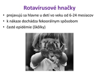 Rotavírusové hnačky
• prejavujú sa hlavne u detí vo veku od 6-24 mesiacov
• k nákaze dochádza fekoorálnym spôsobom
• časté epidémie (škôlky)
 