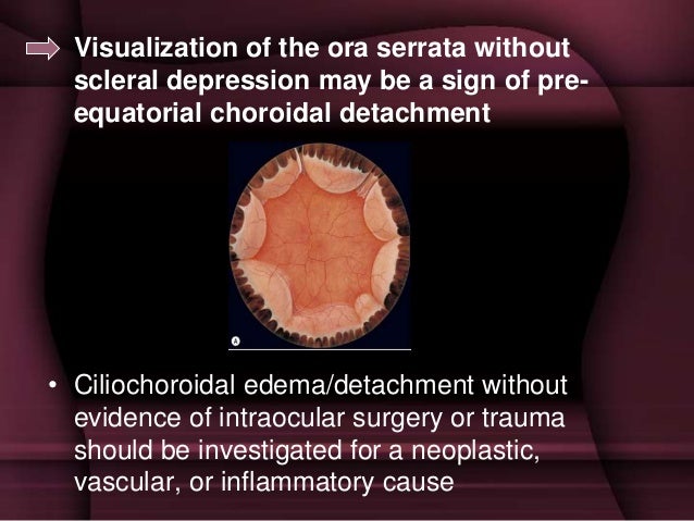 Or Inflammatory Cause 21 Or Inflammatory Cause 21