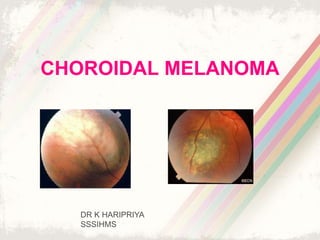 CHOROIDAL MELANOMA
DR K HARIPRIYA
SSSIHMS
 