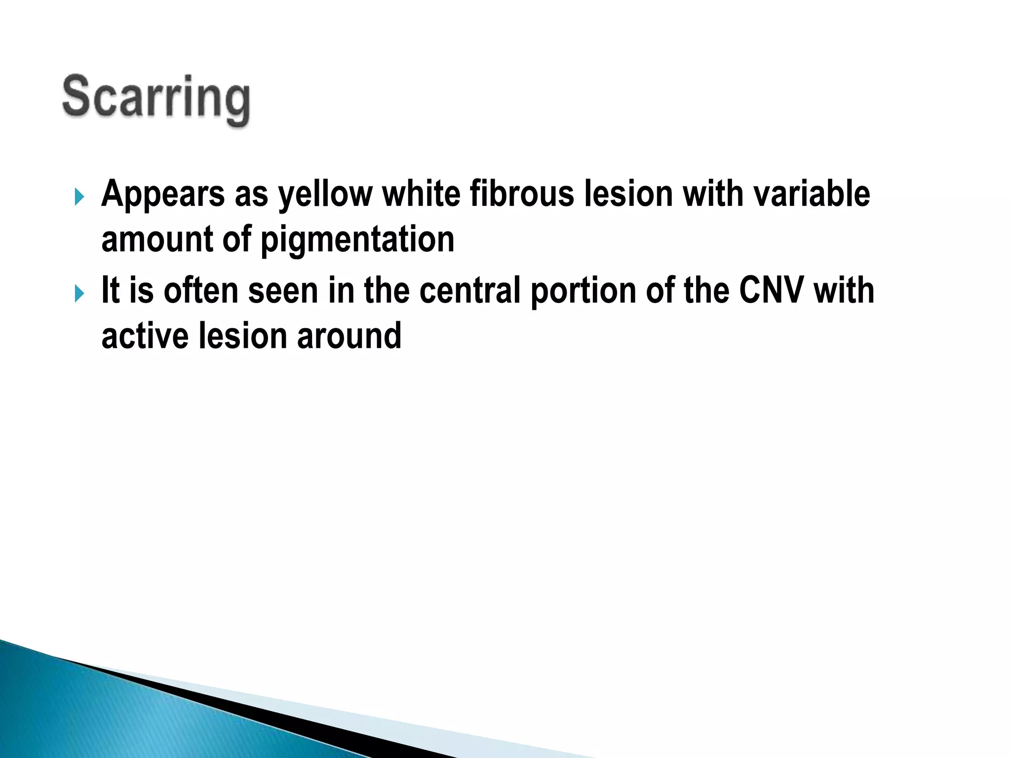  Appears as yellow white fibrous lesion with variable
amount of pigmentation
 It is often seen in the central portion of the CNV with
active lesion around
 
