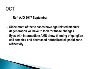 Ref- AJO 2017 September
 Since most of these cases have age related macular
degeneration we have to look for those changes
 Eyes with intermediate AMD show thinning of ganglion
cell complex and decreased normalized ellipsoid zone
reflectivity
 