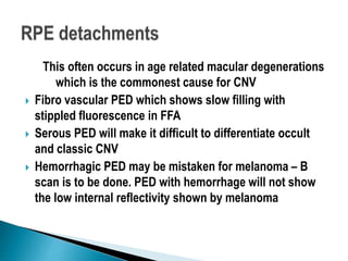 This often occurs in age related macular degenerations
which is the commonest cause for CNV
 Fibro vascular PED which shows slow filling with
stippled fluorescence in FFA
 Serous PED will make it difficult to differentiate occult
and classic CNV
 Hemorrhagic PED may be mistaken for melanoma – B
scan is to be done. PED with hemorrhage will not show
the low internal reflectivity shown by melanoma
 