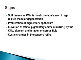  Soft drusen as CNV is most commonly seen in age
related macular degeneration
 Proliferation of pigmentary epithelium
 Elevation of retinal pigmentary epithelium (RPE) by the
CNV, pigment proliferation or serous fluid
 Cystic changes in the sensory retina
 