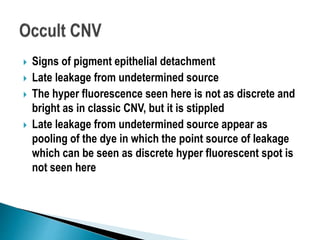 Signs of pigment epithelial detachment
 Late leakage from undetermined source
 The hyper fluorescence seen here is not as discrete and
bright as in classic CNV, but it is stippled
 Late leakage from undetermined source appear as
pooling of the dye in which the point source of leakage
which can be seen as discrete hyper fluorescent spot is
not seen here
 