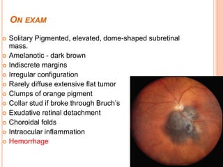 ON EXAM
 Solitary Pigmented, elevated, dome-shaped subretinal
mass.
 Amelanotic - dark brown
 Indiscrete margins
 Irregular configuration
 Rarely diffuse extensive flat tumor
 Clumps of orange pigment
 Collar stud if broke through Bruch’s
 Exudative retinal detachment
 Choroidal folds
 Intraocular inflammation
 Hemorrhage
 