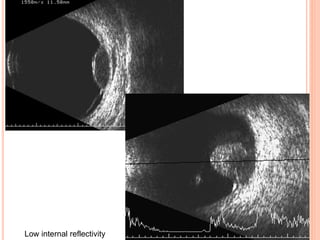 Low internal reflectivity
 