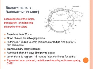 BRACHYTHERAPY
RADIOACTIVE PLAQUE)
Localalization of the tumor,
transparent or metal ring
sutured to the sclera
 Base less than 20 mm
 Good chance for salvaging vision
 Ruthinium 106 (up to 5mm thickness) or Iodine 125 (up to 10
mm thickness)
 Transpupillary thermotherapy
 Removed after 3-7 days (80 gray to apex)
 tumor starts to regress 1-2 months later, continues for years
 Pigmented scar, cataract, radiation retinopathy, optic neuropathy,
CME.
 