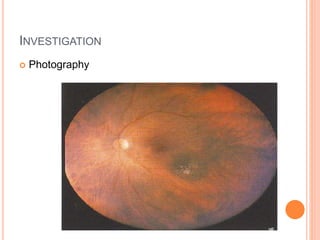 INVESTIGATION
 Photography
 