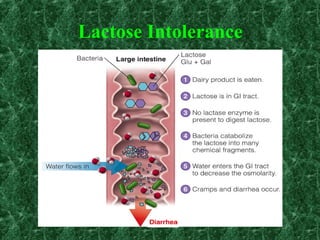 Lactose Intolerance
 