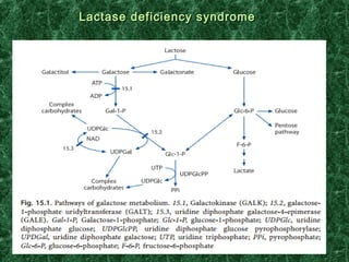 Lactase deficiency syndromeLactase deficiency syndrome
 