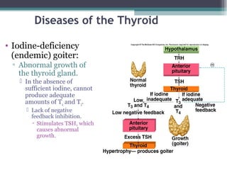 Diseases of the Thyroid
• Iodine-deficiency
(endemic) goiter:
▫ Abnormal growth of
the thyroid gland.
 In the absence of
sufficient iodine, cannot
produce adequate
amounts of T4 and T3.
 Lack of negative
feedback inhibition.
▫ Stimulates TSH, which
causes abnormal
growth.
 