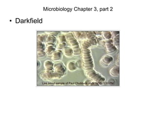 Microbiology Chapter 3, part 2
• Darkfield
 