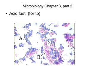 Microbiology Chapter 3, part 2
• Acid fast (for tb)
 