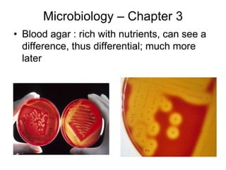 Microbiology – Chapter 3
• Blood agar : rich with nutrients, can see a
difference, thus differential; much more
later
 