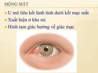 chắp lẹo mộng mắt 2.pdf