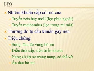 chắp lẹo mộng mắt 2.pdf