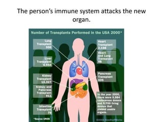 The person’s immune system attacks the new
                 organ.
 