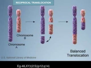 RECIPROCAL TRANSLOCATION
 