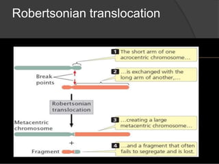 Robertsonian translocation
 