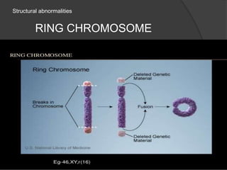 Structural abnormalities
RING CHROMOSOME
 