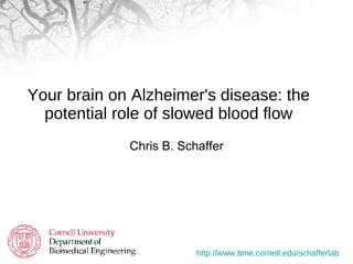 Your brain on Alzheimer's disease: the potential role of slowed blood flow ,[object Object]