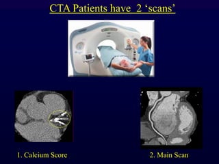 CTA Patients have 2 „scans‟
rtery Scanning
N
1. Calcium Score 2. Main Scan
 