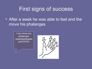 First signs of success After a week he was able to feel and the move his phalanges I can move my phalanges yipeeeeeeeeeeeee!!!!!!!!!!!!! 