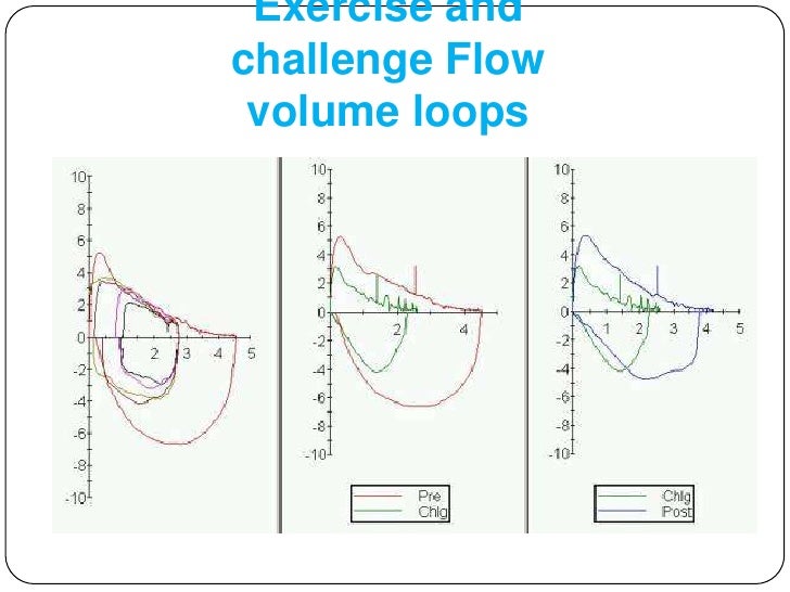 Exercise Induced Asthma