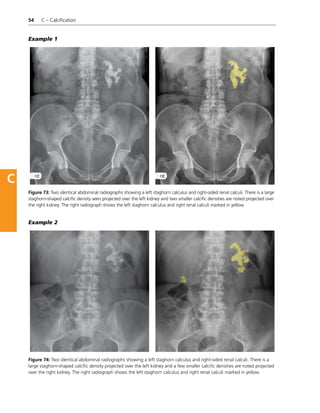Christopher_Clarke,_Anthony_Dux_Abdominal_X_rays_for_Medical_Students.pdf