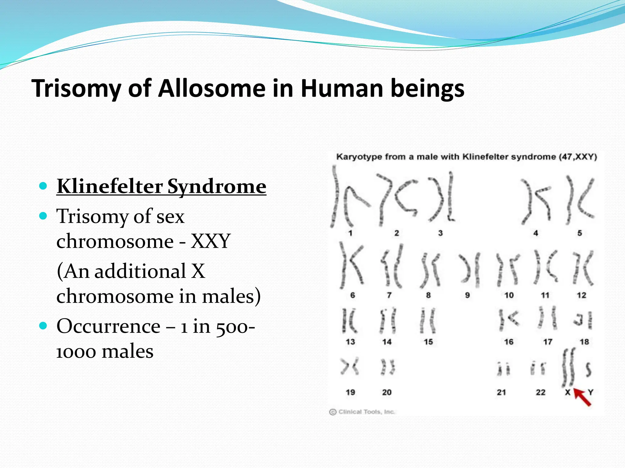 Trisomy of Allosome in Human beings
 Klinefelter Syndrome
 Trisomy of sex
chromosome - XXY
(An additional X
chromosome in males)
 Occurrence – 1 in 500-
1000 males
 