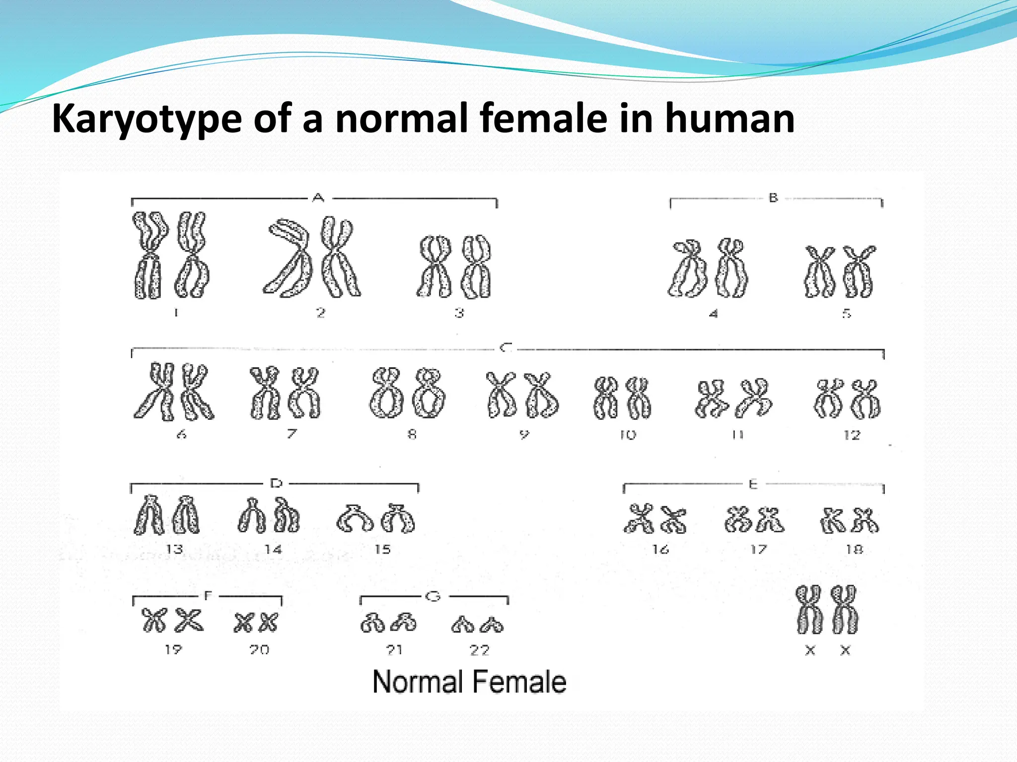 Karyotype of a normal female in human
 